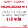 Royal Canin Hair & Skin Care - száraz táp felnőtt macskák részére a szebb szőrzetért és az egészséges bőrért  400 g
